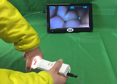 X 1,5 Pembesaran Digital Elektronik colposcope terhubung ke TV atau komputer atau Medis Monitor Untuk Kesehatan Wanita
