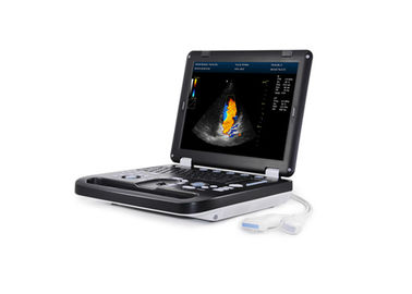 15 inch Full Digital Portable Ultrasound Scanner Peralatan Medis Ultrasonik Diagnostik