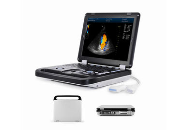 Mesin Doppler Warna Full Digital 2D Berkualitas Tinggi Untuk Tes Kehamilan Dengan Probe Cembung