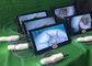 Portable Self-Colposcope Untuk Ginekologi Terhubung Untuk Monitor Televisi Komputer