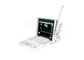 1024 Frame Laptop Perangkat Warna Doppler Scanner Ultrasound Portabel Dengan 2 Konektor Probe