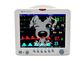 5 Parameter Patient Monitor Pet Gunakan Sistem Multi Parameter Monitoring untuk Perangkat Pemantauan Pasien Hewan Hewan